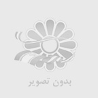 هرآنچه که باید درباره ارتودنسی لینگوال بدانید!